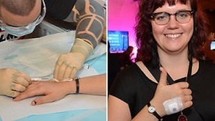 Swedish woman gets microchip 'key' implanted in hand