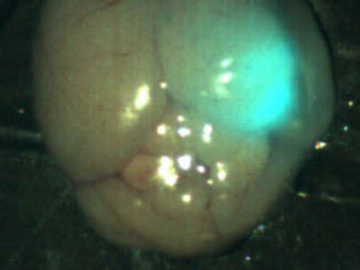 tumor paint