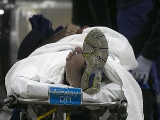 Hair Caught In Escalator