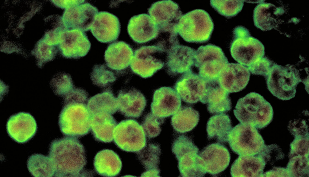 brain-eating amoeba