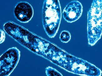 Legionnaire's Disease