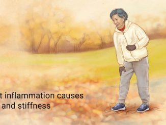 arthritis