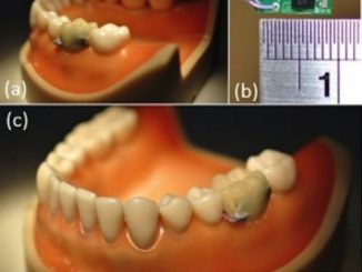bluetooth tooth