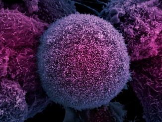 Russia develop nanosensor capable of detecting early signs of HIV and Cancer