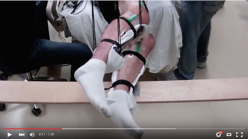 New paralysis treatment offers hope to paralysis patients