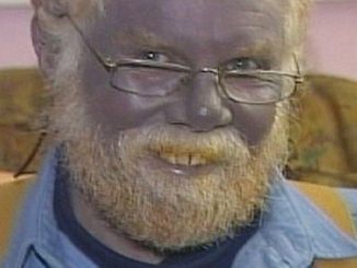 colloidal silver