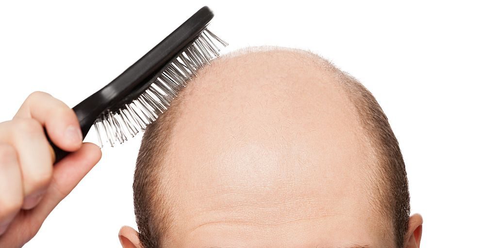 cure baldness