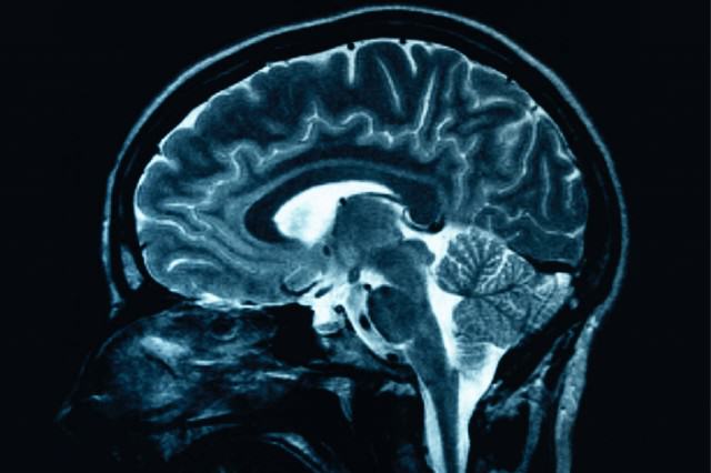 Blind woman "B.T." can see again after switching personalities