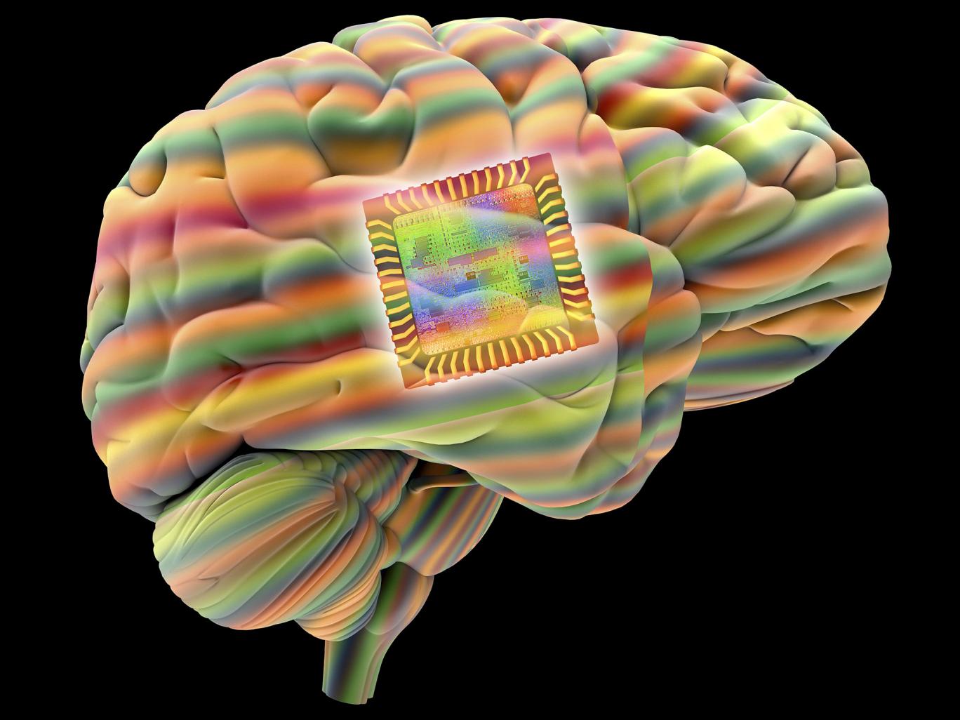 brain implant