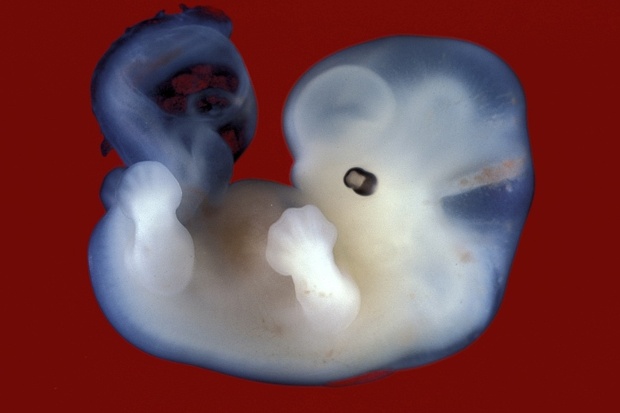 Scientists in the UK have been given the go-ahead to work on genetically modified embryo's