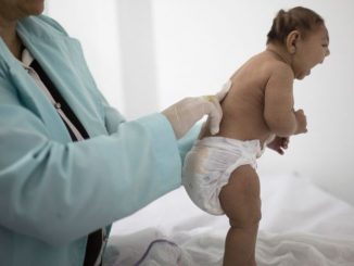 CDC fabricate evidence linking Zika virus to microcephaly