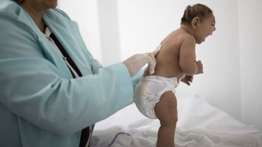 CDC fabricate evidence linking Zika virus to microcephaly