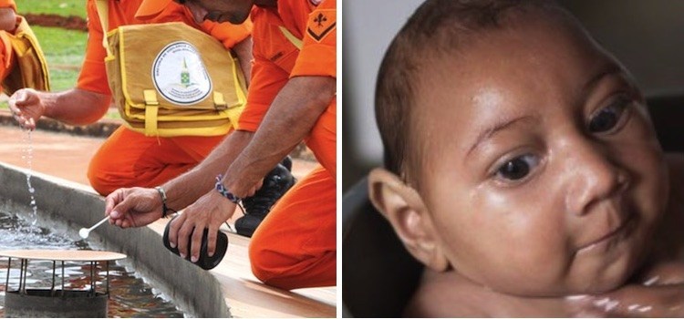 Doctors blame Monsanto for Microcephaly outbreak in Brazil