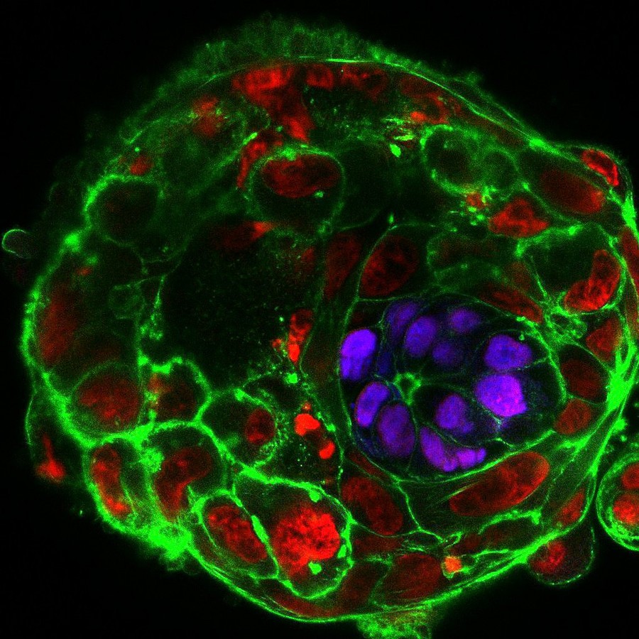 This image shows day 10 of embryo development © University of Cambridge 