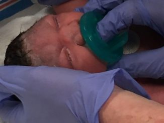 Mom in New Jersey gives birth to Microcephaly baby