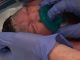 Mom in New Jersey gives birth to Microcephaly baby