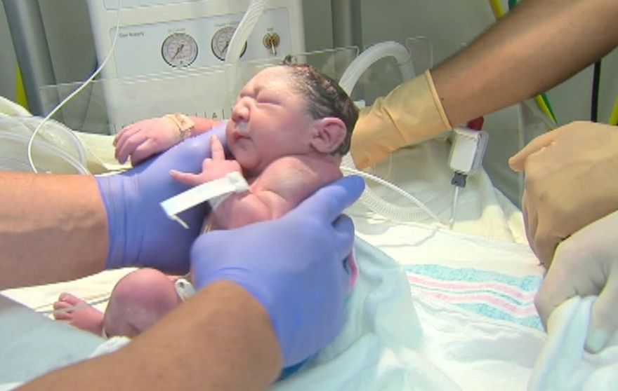 CDC warn that a bunch of kids are about to develop microcephaly