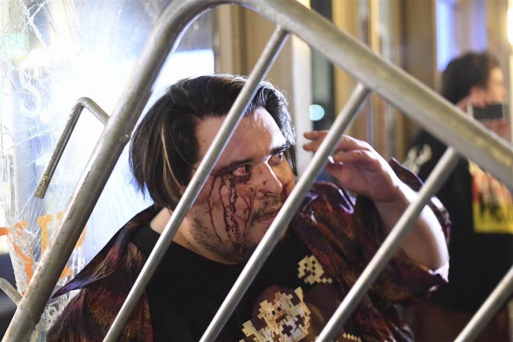 UC Berkeley staff beat milo audience member to a bloody pulp