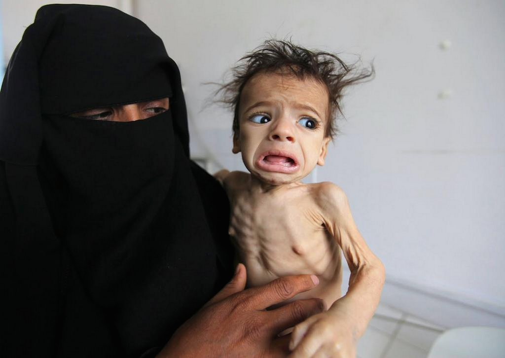 UN report warns of famine for 60% of people in Yemen