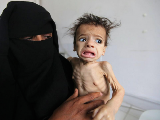 UN report warns of famine for 60% of people in Yemen