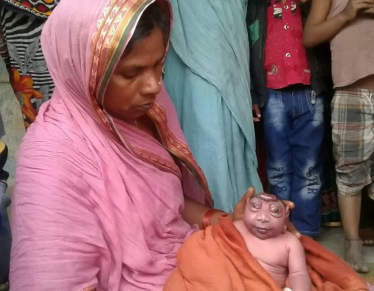 Indian mother claims to have given birth to Nephilim ceature