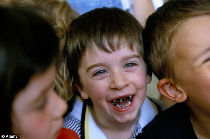 Ireland gripped by tooth decay crisis following the mass fluoridation of their water supply