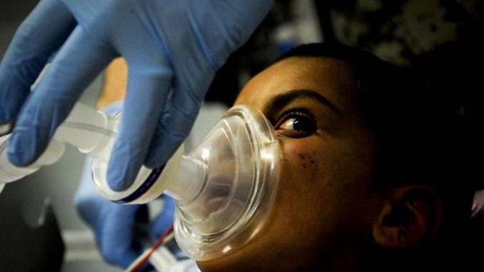 Study shows that general anesthetic can cause brain damage