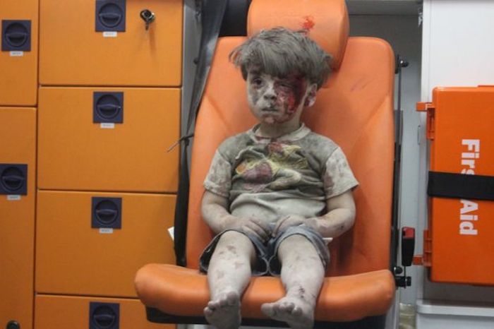 White Helmets lied about Aleppo Boy's injuries, admits father