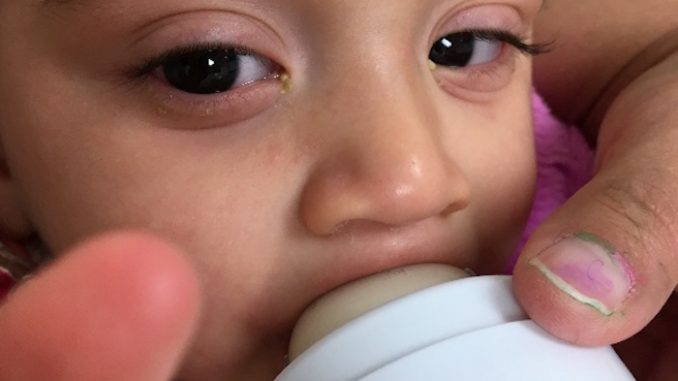 Negligent doctor accidentally vaccinated and injured baby with gardasil, then the government blamed the mother and removed the child from her care.