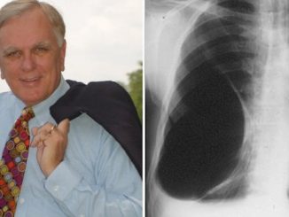 After being diagnosed with a terminal illness, Judge Dough Bench, who hated cannabis, turned to the plant as a last resort and it saved his life.