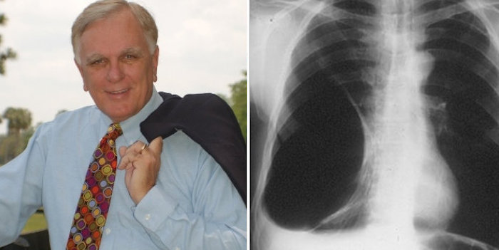 After being diagnosed with a terminal illness, Judge Dough Bench, who hated cannabis, turned to the plant as a last resort and it saved his life.