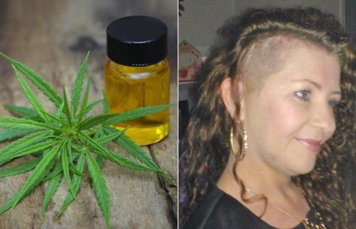 Scottish woman cures her own terminal brain cancer using cannabis oil