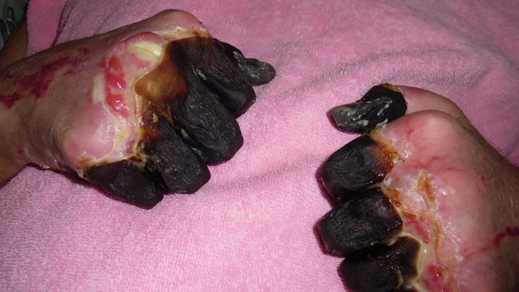 World Health Organization warns Black Death plague is coming back