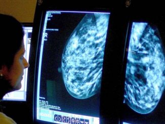 Women with high cholesterol less likely to develop breast cancer, scientists say