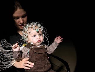 Autistic children's brains are loaded with aluminium according to a shocking new study