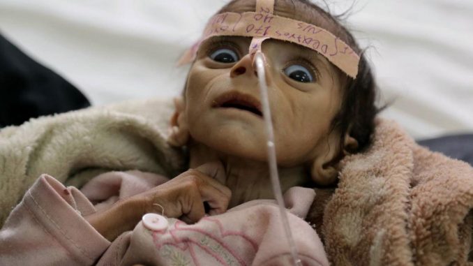 400k children starving to death in Yemen, UN report finds