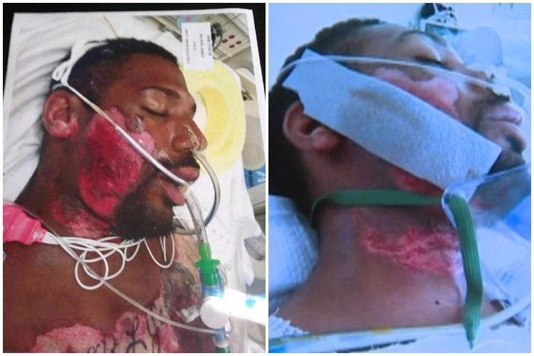 Cops hold down disabled man on hot pavement until his face melts away