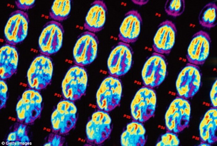 NIH study links cell phone radiation to particularly aggressive forms of cancer