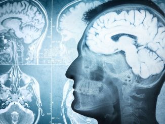 US scientists say they have found a link between people who are Christian and brain damage