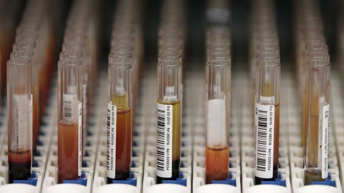 Employers across the nation struggling to fill jobs have begun to relax or eliminate drug testing requirements because "nobody is passing."