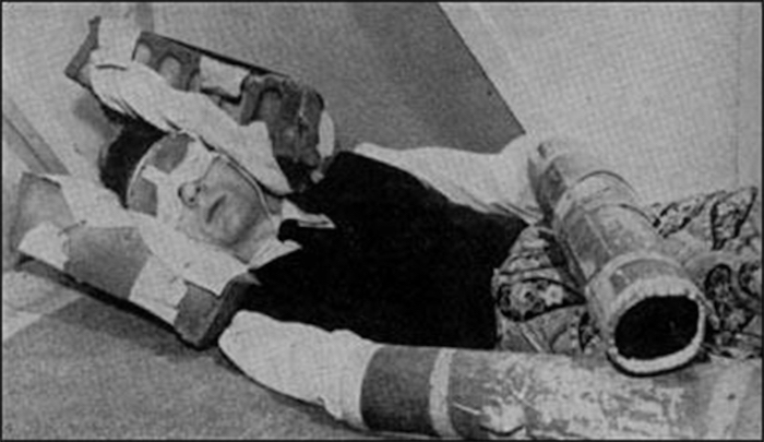 CIA apologise for using MKUltra experiments on Canadian psychiatric patients