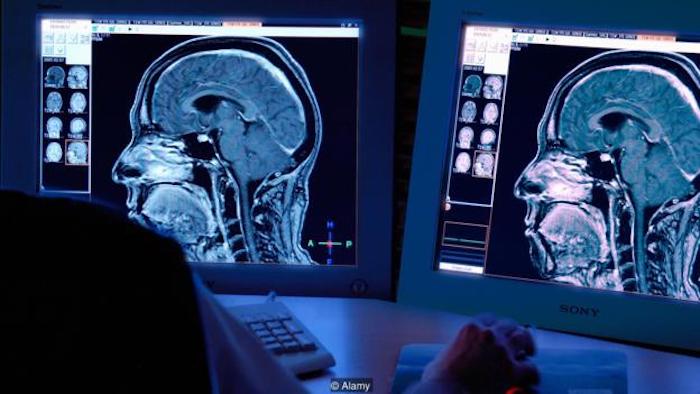 Scientists from Northwestern University have continued their war on Christianity, publishing a study in the journal Neuropsychologia stating that Christians who believe in the Bible have a form of "brain damage."