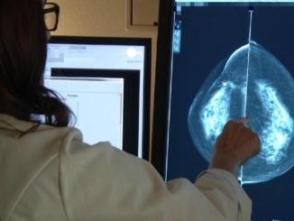 Chemotherapy is completely useless for breast cancer patients, study finds