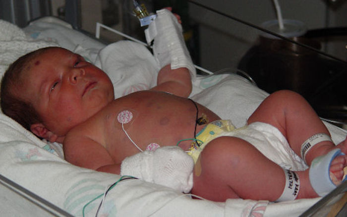 Study shows that Formaldehyde in vaccinations causes leukemia