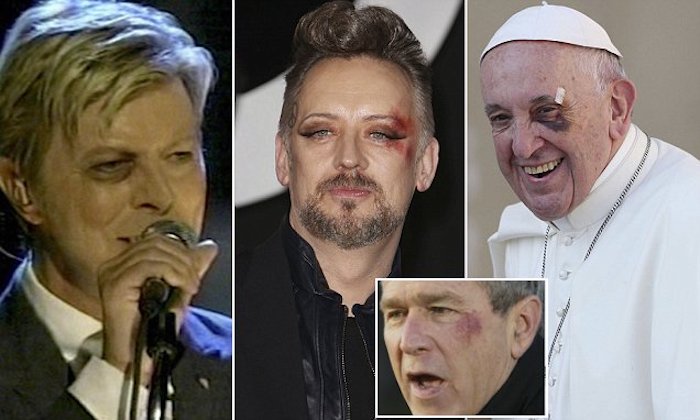 Celebrities and politicians with left black eyes are part of the Illuminati