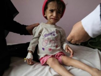 Yemen on brink of worse famine in 100 years