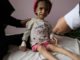 Yemen on brink of worse famine in 100 years