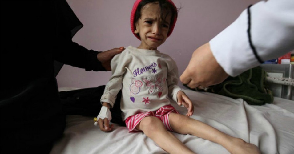 Yemen on brink of worse famine in 100 years