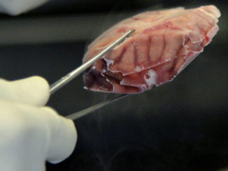 Lab-grown organs begin developing brain cells