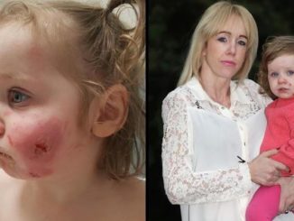 A toddler has been scarred for life after being bitten 15 times by boys who "took at least ten chunks" out of her and then "strangled" her.